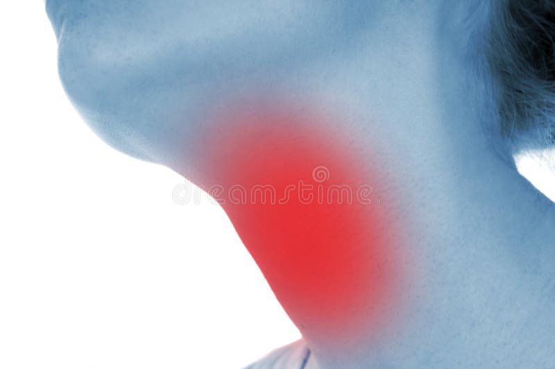 Gola irritata, indicata rosso immagini stock libere da diritti Gola irritata, indicata rosso immagini stock libere da diritti