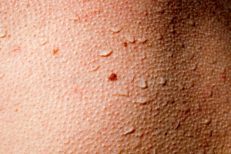 108 Goosebumps Skin Photos Free & RoyaltyFree Stock Photos from