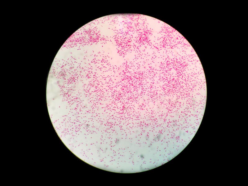 Bacillus On Gram Stain