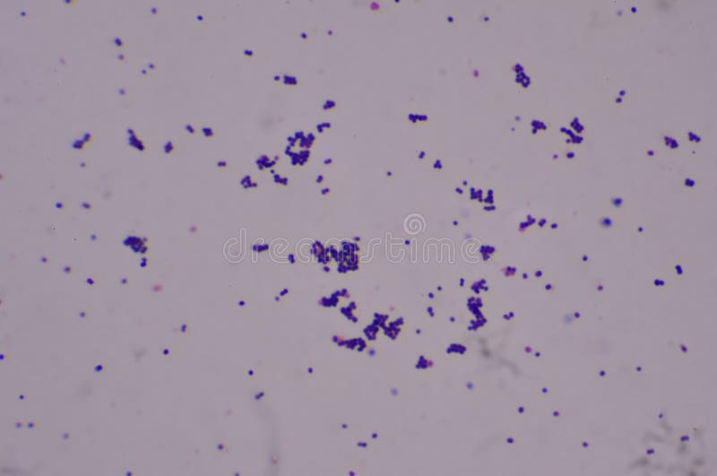 Bacillus Gram Positive Stain Under Microscope View. Bacillus is Rod
