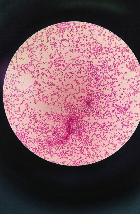 Gram Staining , Also Called Gram S Method, Gram Positive Coccus Stock