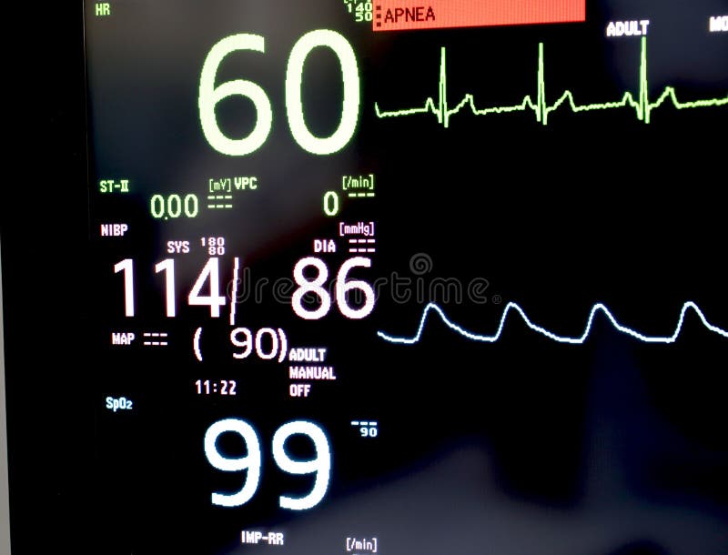 Vital signs monitor in a hospital where doctors use to check patient heart waves to diagnose and treat hospitals, clinics. Vital signs monitor in a hospital where doctors use to check patient heart waves to diagnose and treat hospitals, clinics