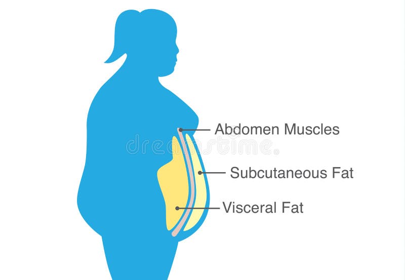 Visceral fat and subcutaneous fat that accumulate around waistline of woman. Illustration about medical diagram. Visceral fat and subcutaneous fat that accumulate around waistline of woman. Illustration about medical diagram.