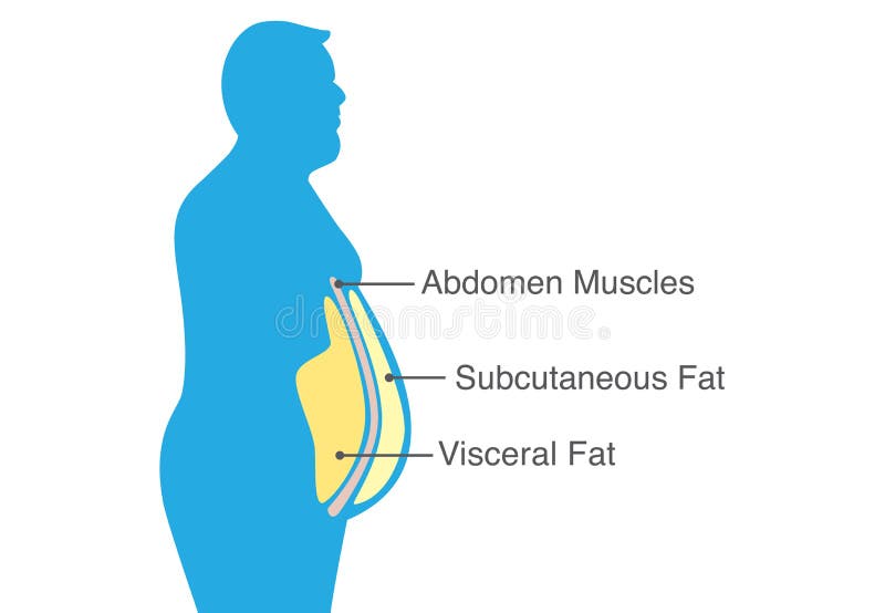 Visceral fat and subcutaneous fat that accumulate around your waistline. Illustration about medical diagram. Visceral fat and subcutaneous fat that accumulate around your waistline. Illustration about medical diagram.