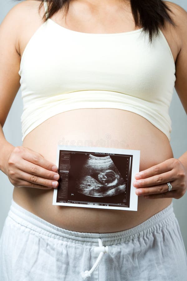 gravid kvinna arkivfoto gravid kvinna arkivfoto