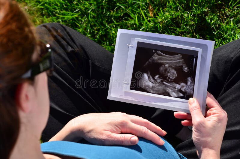 Gravidanza - donna incinta che esamina ricerca di ultrasuono fotografia stock Gravidanza - donna incinta che esamina ricerca di ultrasuono fotografia stock