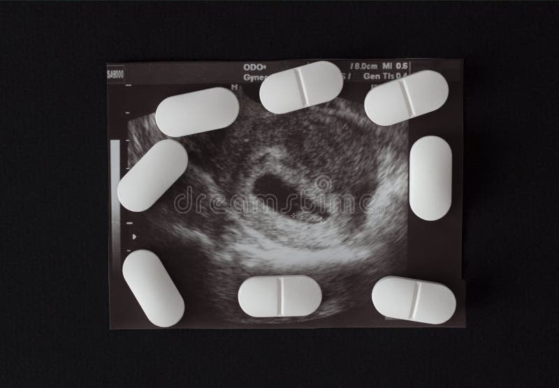 Gravidanza, un colpo dell'uzi e pillole su un fondo nero Aborto, primo piano medico fotografie stock libere da diritti Gravidanza, un colpo dell'uzi e pillole su un fondo nero Aborto, primo piano medico fotografie stock libere da diritti