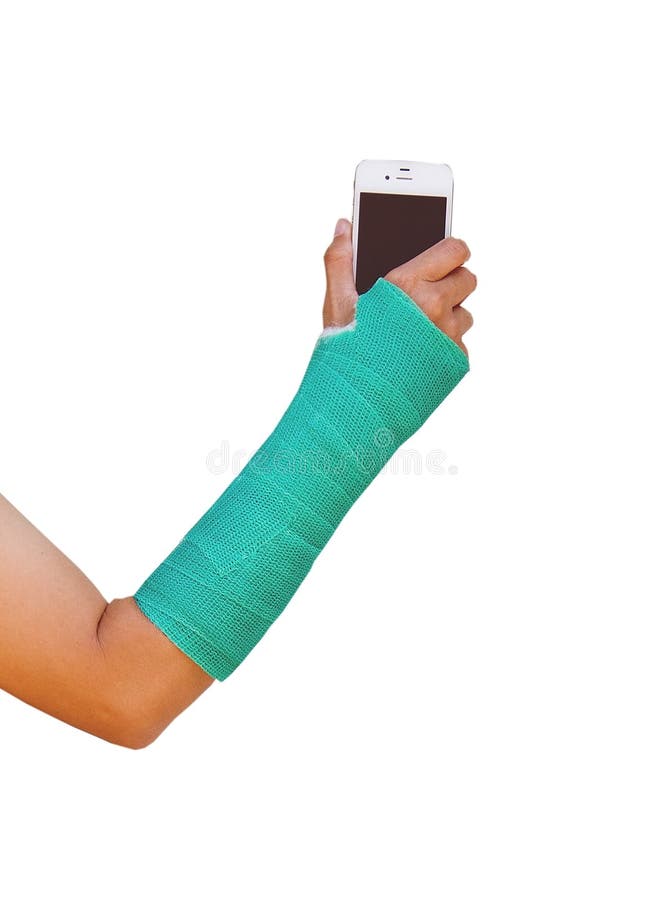Green Cast on Hand and Arm, Holding Mobile Phone. Stock Image Image