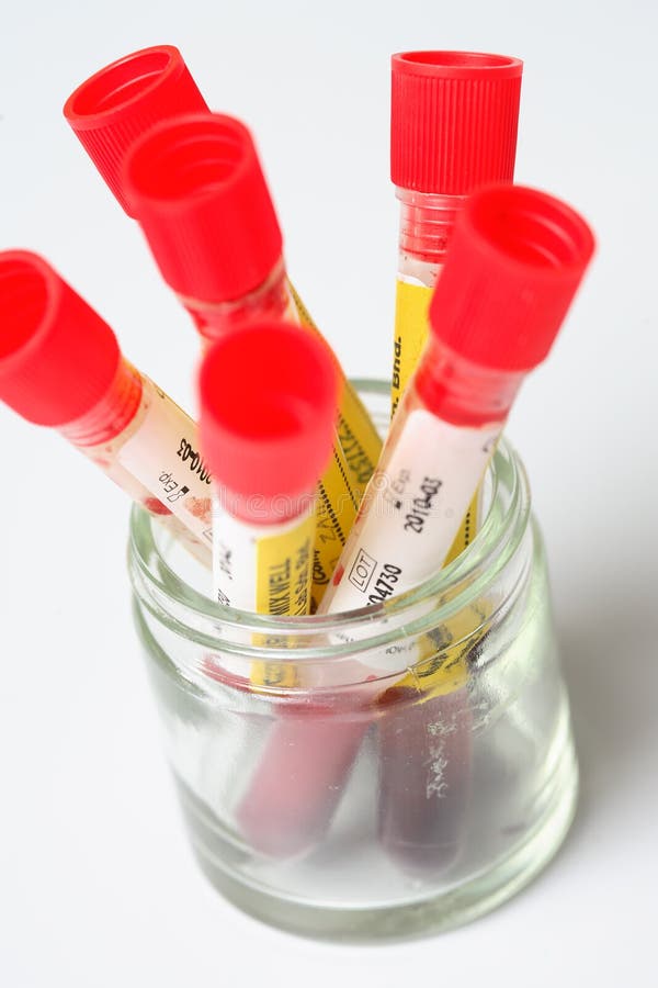 A Group of Blood Test Tubes Stock Photo Image of medical, test 3086080