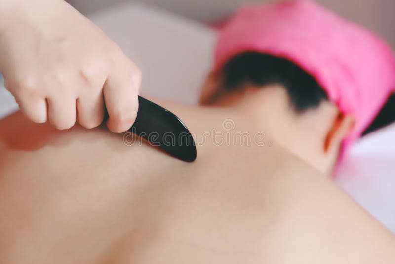 Gua-Sha Acupuncture Treatment on Back