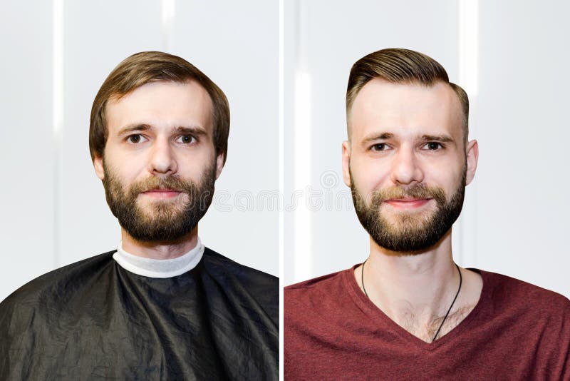 Guy before after Haircut Concept for a Barber Shop: the Problem Man of Hair  Loss, Alopecia, Transplantation Stock Photo - Image of head, concept:  187929060