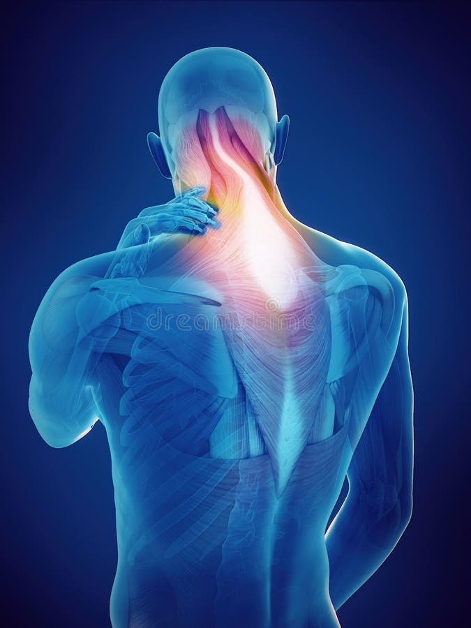 Neck pain stock illustration. Illustration of bones, human 3195126