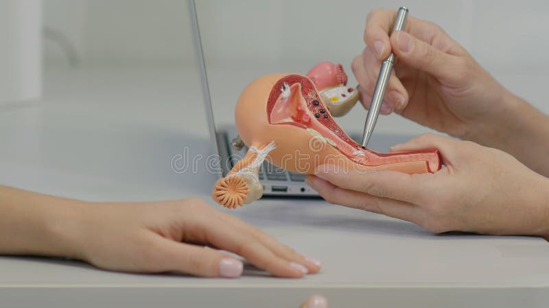 Gynecologist doctor consulting patient using uterus anatomy model. Close up shot. Professional shot in 4K resolution. 097. You can use it e.g. in your commercial video, business, medicine, healthcare, technology, presentation, broadcast video.