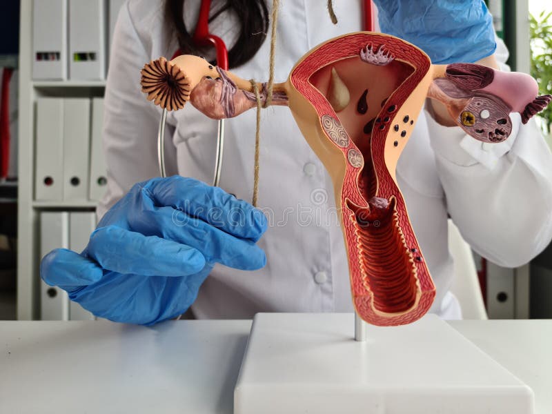 Gynecologist ligates fallopian tubes using model of the female reproductive system as example. Contraception for unwanted pregnancy. Gynecologist ligates fallopian tubes using model of the female reproductive system as example. Contraception for unwanted pregnancy