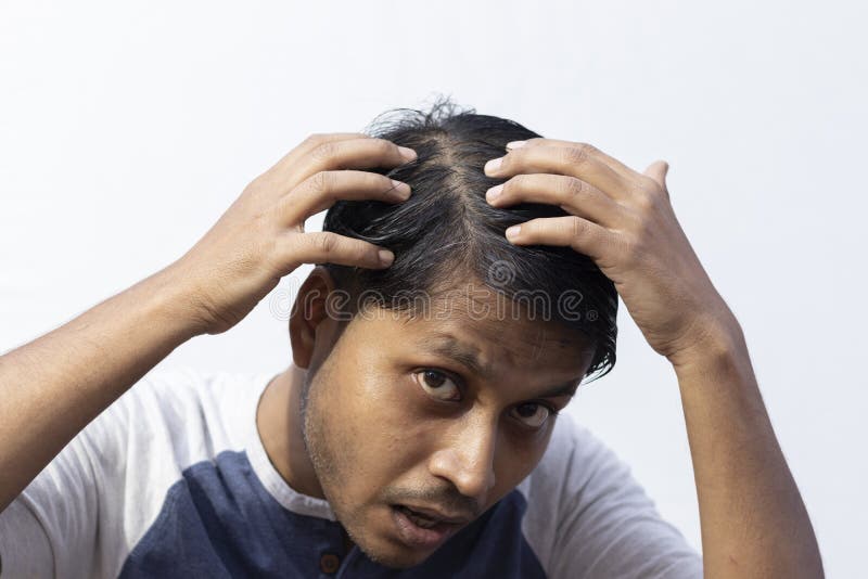 Hair Problems Treatment Service