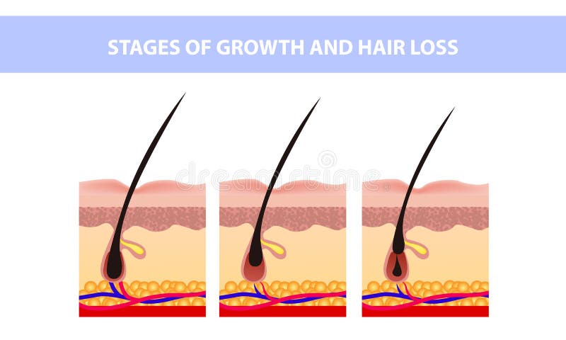 Hair Growth Phase Step by Step. Stages of the Hair Growth Cycle. Anagen,  Telogen, Catagen. Anatomy of the Skin Stock Vector - Illustration of  medicine, problem: 190768867
