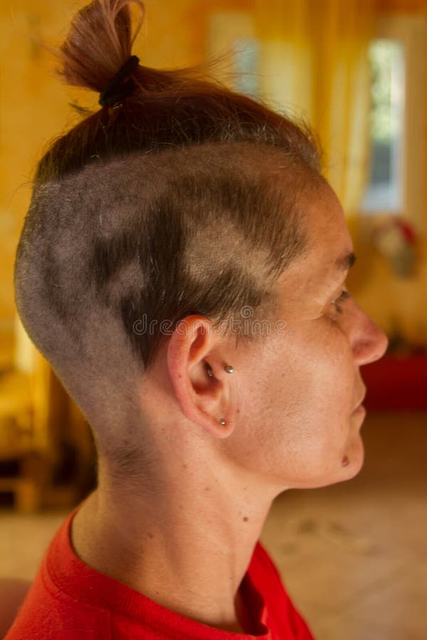Hair Loss after Chemotherapy on a Girl with Hair Lost or Cut To the Ground  Stock Image - Image of health, cancer: 200738233