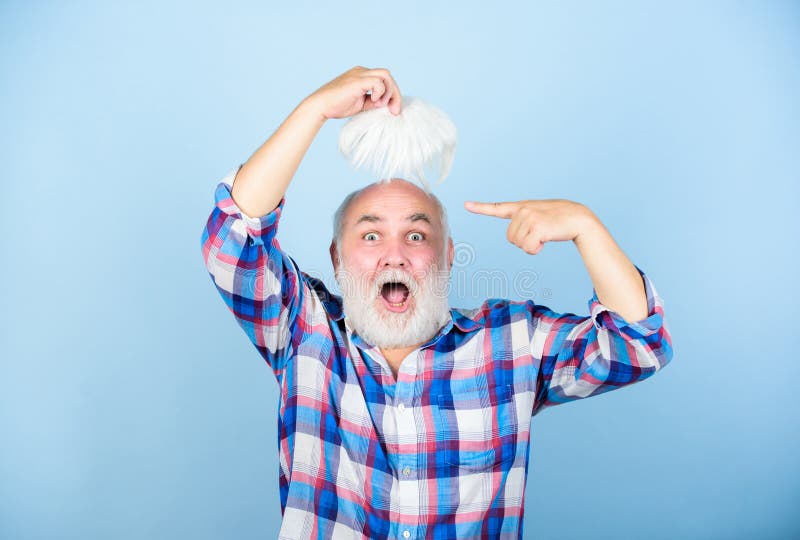 Hair loss. Early signs balding. Man losing hair. Artificial hair. Health care concept. Male pattern baldness genetic royalty free stock photo Hair loss. Early signs balding. Man losing hair. Artificial hair. Health care concept. Male pattern baldness genetic royalty free stock photo