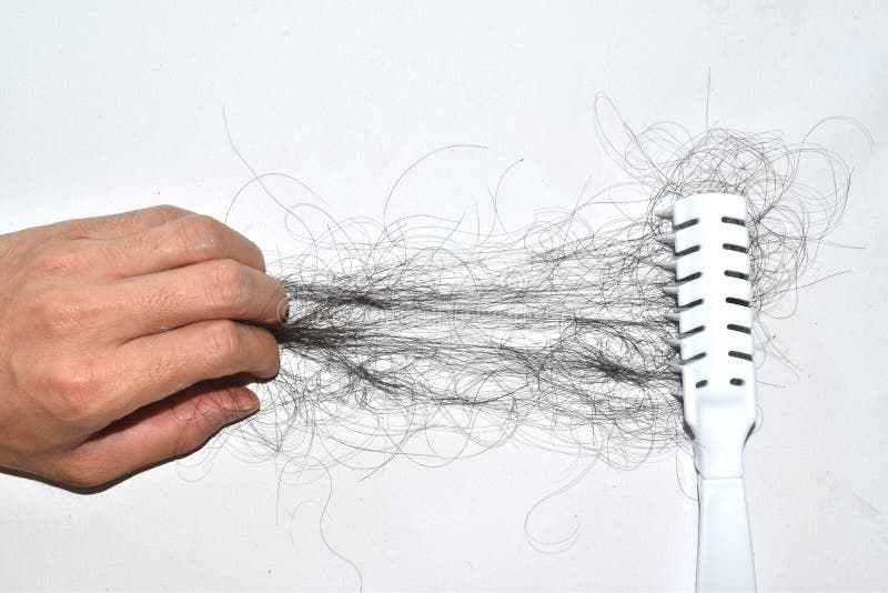 Hair Loss Problems are Many Stock Photo Image of caucasian, damage