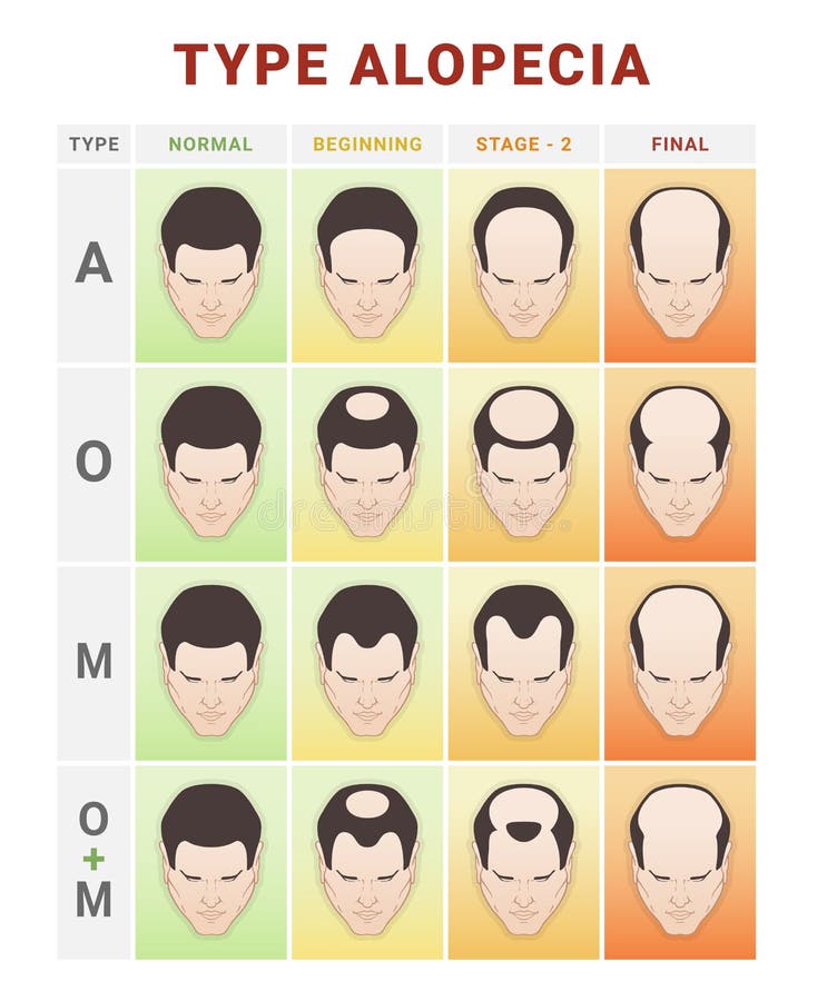 Hair Type Chart Stock Illustrations – 263 Hair Type Chart Stock  Illustrations, Vectors & Clipart - Dreamstime