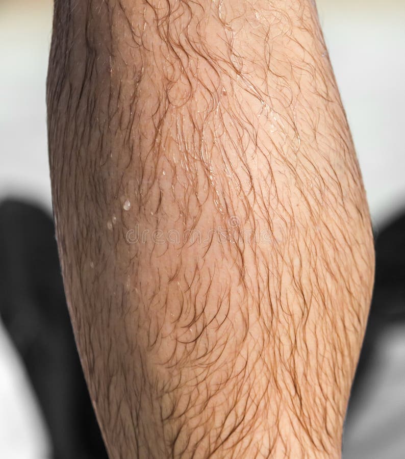 Hair on a Man’s Leg As a Background Stock Photo - Image of feet, parts: 181471884 Hair on a Man’s Leg As a Background Stock Photo - Image of feet, parts: 181471884