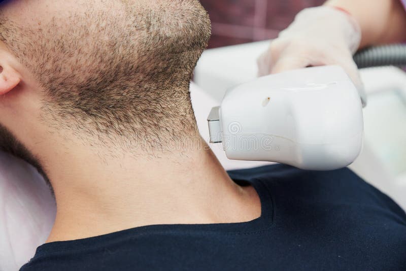 Hair Removal Using a Laser Device. the Nozzle of the Device Near the Man`s  Chin Stock Photo - Image of health, machine: 182862172
