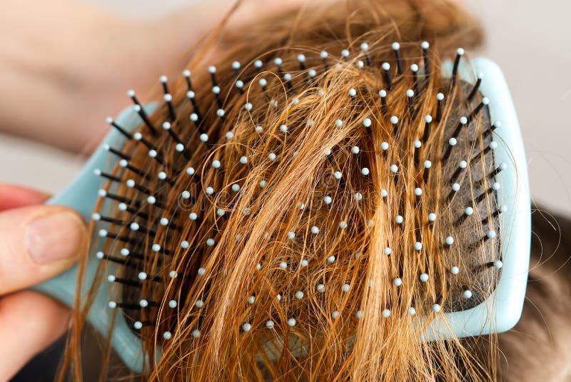 Hair stuck on a comb, blurred background. Hair brush with damaged hair. Hair loss problem. Bad hair falling out