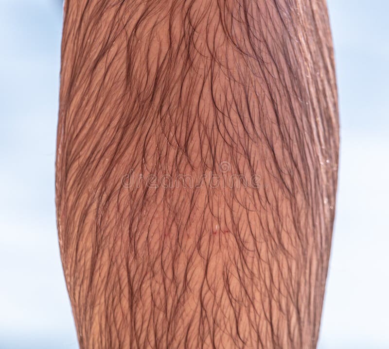 16,263 Hairy Legs Stock Photos Free & RoyaltyFree Stock Photos from Dreamstime