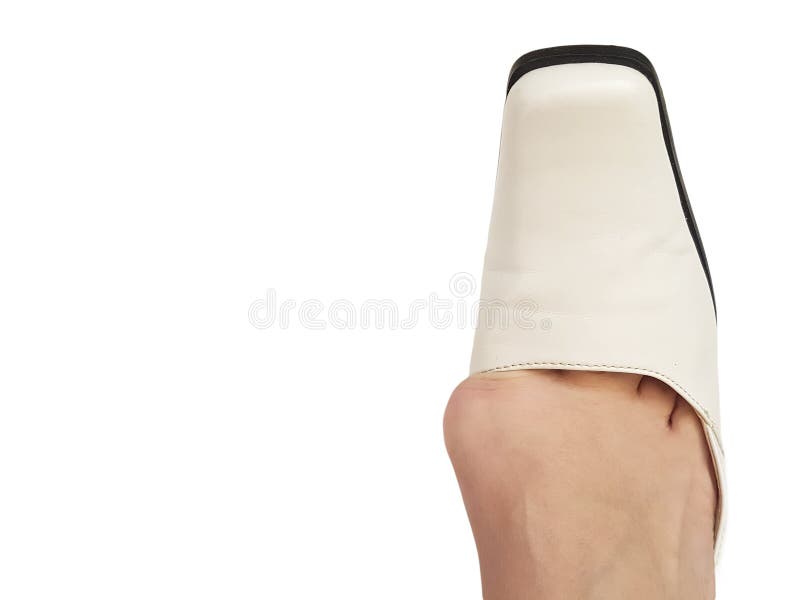 Hallux valgus-Deformation, Beine, podologische Schuhanatomie lokalisierte Weiß, schmerzende Gelenke des Patienten lizenzfreie stockfotografie Hallux valgus-Deformation, Beine, podologische Schuhanatomie lokalisierte Weiß, schmerzende Gelenke des Patienten lizenzfreie stockfotografie