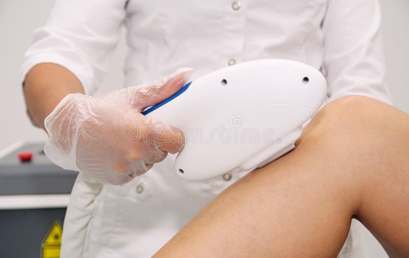 Hand of the Beautician Holds the Machine and Conducts Laser Hair Removal of  the Legs Stock Photo - Image of attractive, person: 192688732
