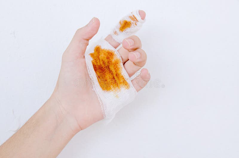 1 531 Hand Blood Bandage Photos Free Royalty Free Stock Photos From Dreamstime