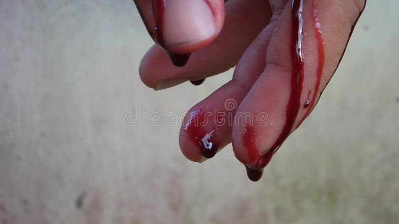 Hand of Blood. Man Wounded Man in the Blood Stock Video - Video of close,  execute: 40541517