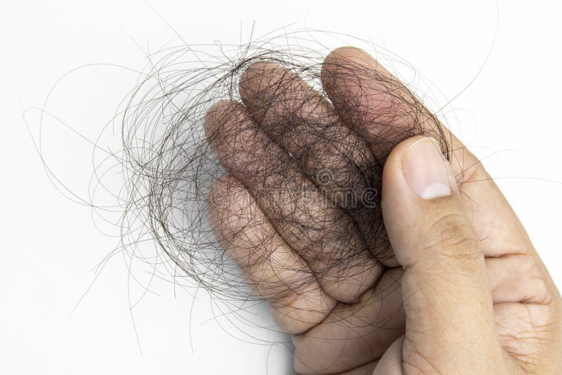 Hand is Holding Hair Fall on White Screen. Stock Photo - Image of baldness, close: 191469994 Hand is Holding Hair Fall on White Screen. Stock Photo - Image of baldness, close: 191469994