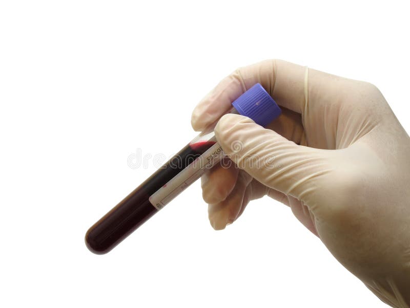 Hand Holding Vacuum Venipuncture Test Tube Stock Photo Image of blood