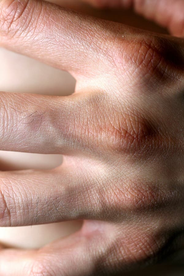 The Hand of a Massage Therapist Stock Photo Image of massage, hand