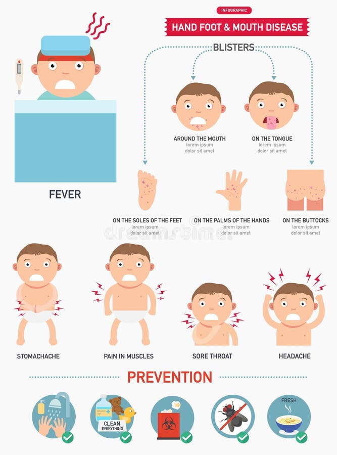 Hand, Maul- und Klauenseuche infographic stock abbildung Hand, Maul- und Klauenseuche infographic stock abbildung