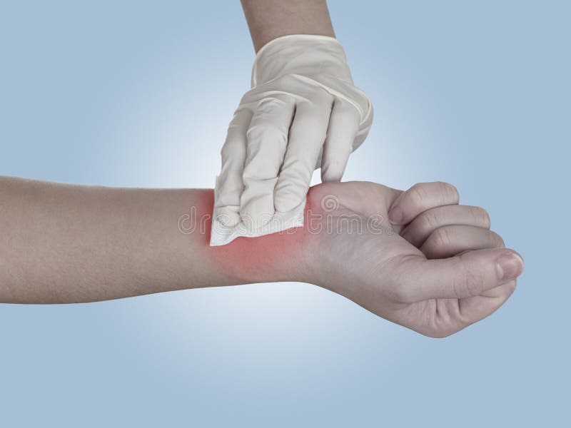 Hand Pressing Gauze on Arm. Stock Photo Image of isolated, wound