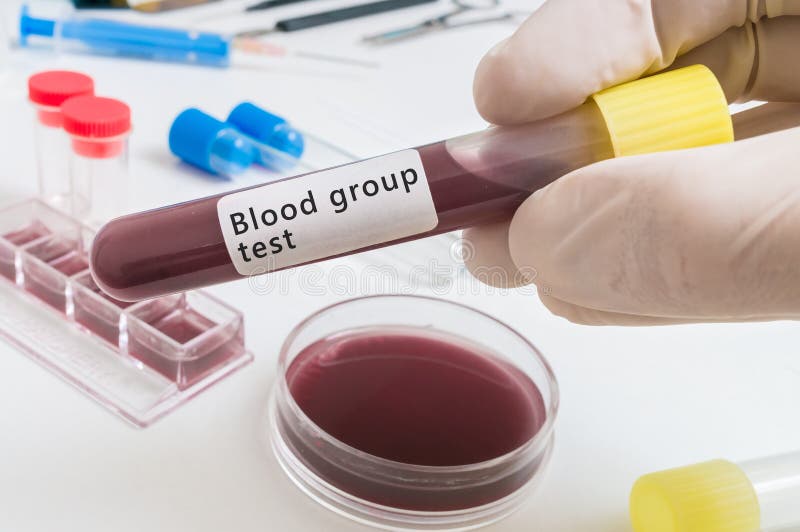 Hand of scientist holds test tube with blood for Bloof group test stock image Hand of scientist holds test tube with blood for Bloof group test stock image