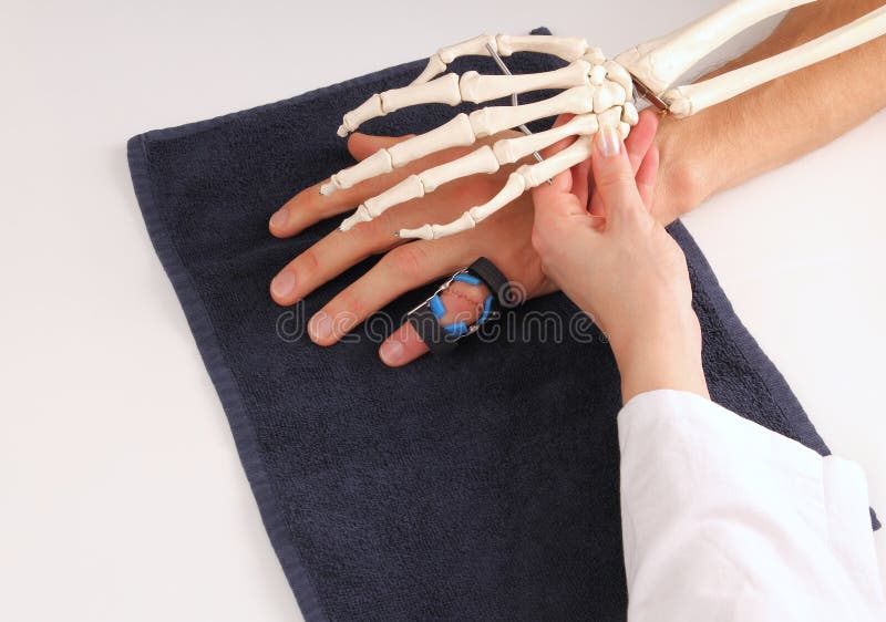 Hand surgeon with skeleton hand at patient.