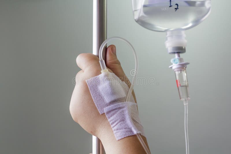 Hand swollen by saline intravenous (iv). royalty free stock photo Hand swollen by saline intravenous (iv). royalty free stock photo