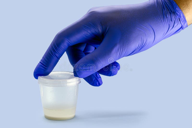 Hand Wearing Nitrile Glove Holding Semen Or Sperm Sample Collection Container Semen Donation