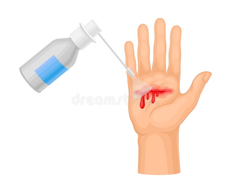 Wound Stock Illustrations – 18,234 Wound Stock Illustrations, Vectors &  Clipart - Dreamstime