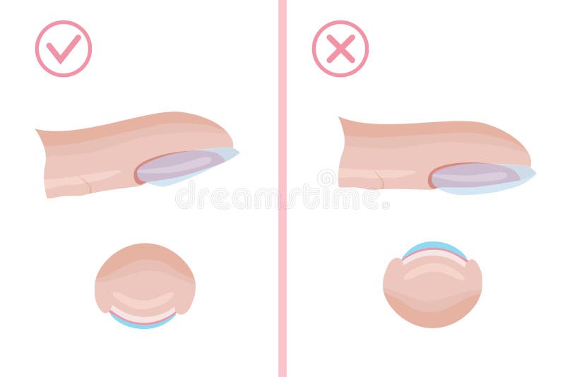 Hand nail care. The technique of applying the base layer of manicure, right and wrong. Illustration for the manicure guide. Hand nail care. The technique of applying the base layer of manicure, right and wrong. Illustration for the manicure guide.