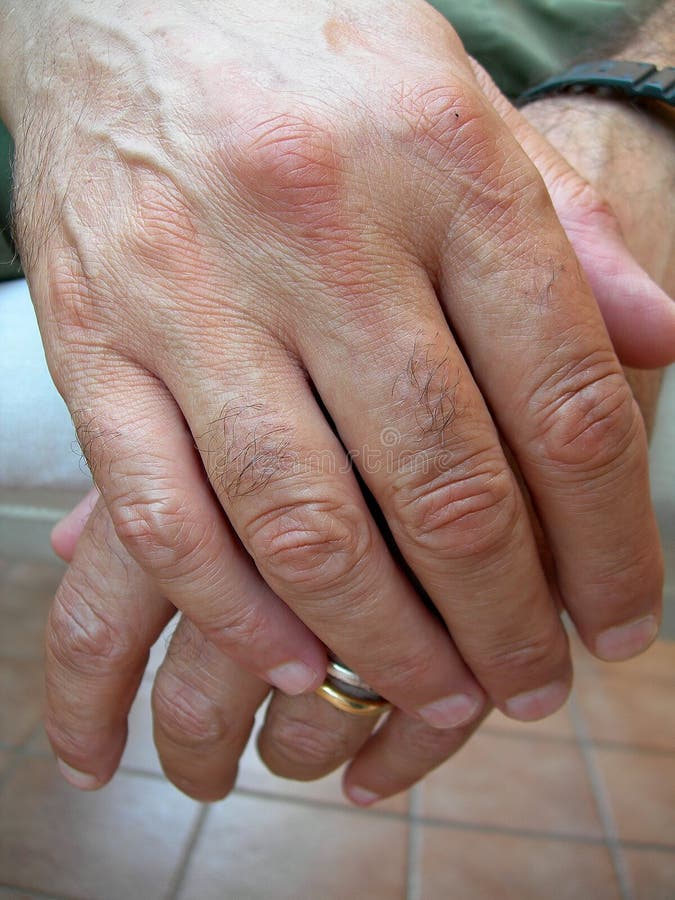 Hands Picture. Image 3068832