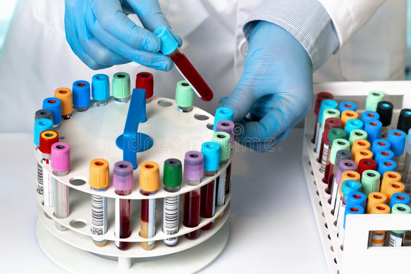 Hands holding blood tube and rack in the analysis laboratory royalty free stock images Hands holding blood tube and rack in the analysis laboratory royalty free stock images