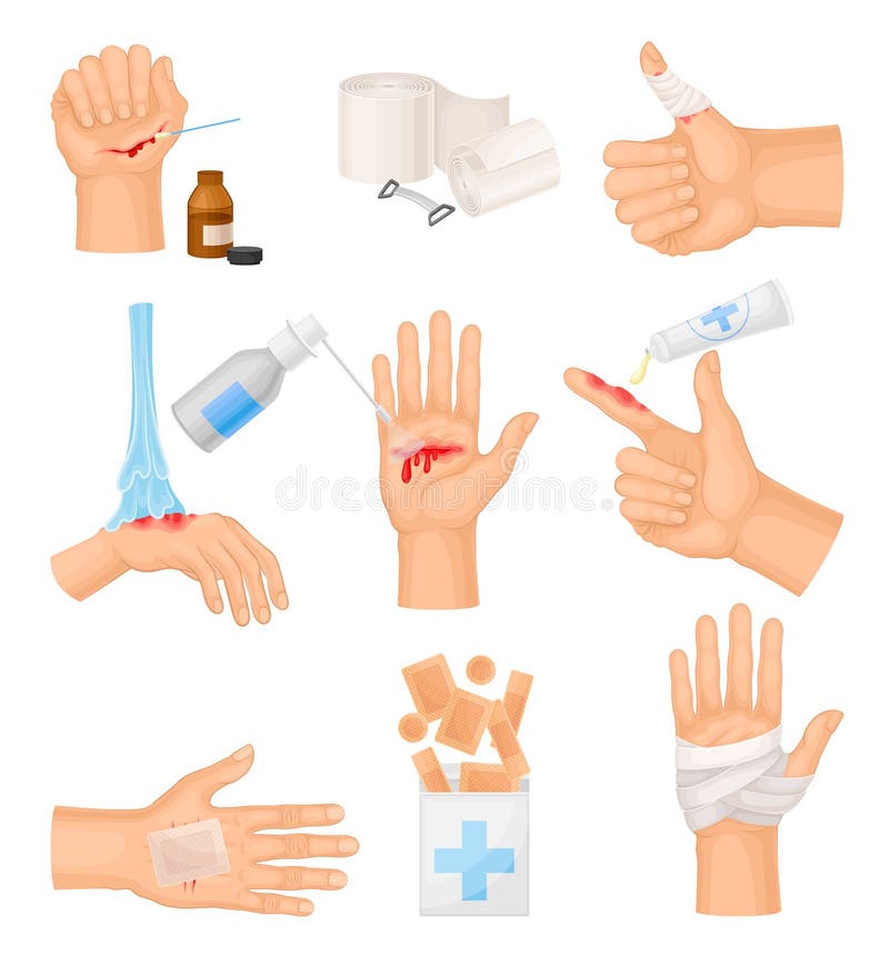 Hands with Injured Skin and Procedures of Bandaging and Wound Cleaning ...