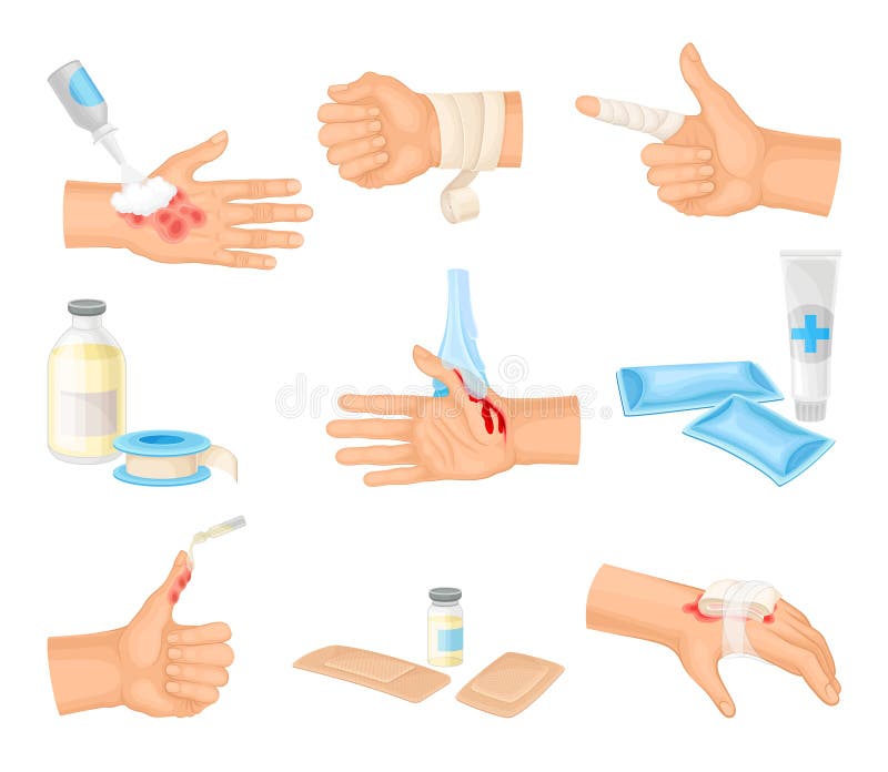 Hands with Injured Skin and Procedures of Bandaging and Wound Cleaning ...