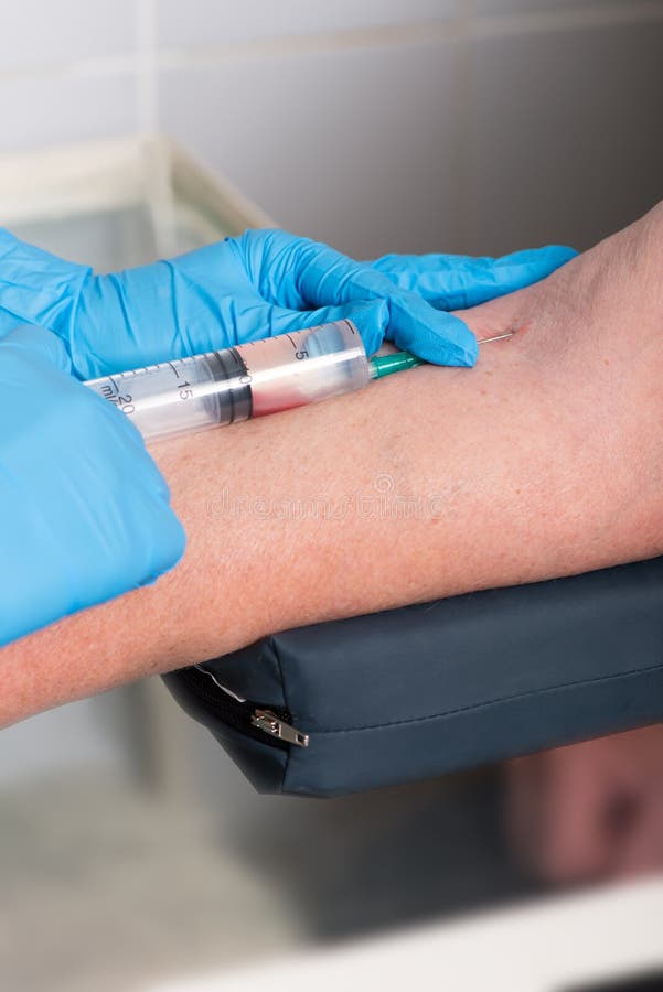 Hands in Rubber Medical Gloves Do an Injection in a Vein Stock Image