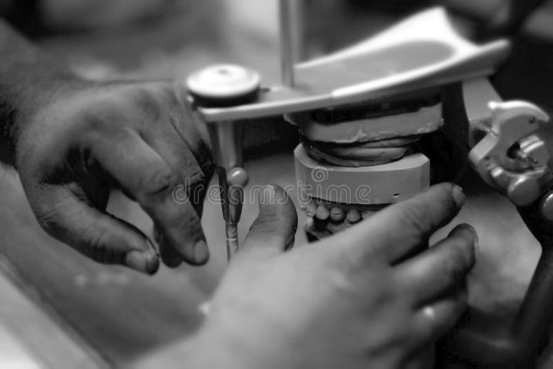 Hands of a Specialist in the Process of Manufacturing a Prosthesis