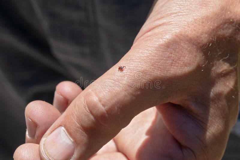 Handzeichen Ixodes ricinus Parasitenmilbe Gefährliche Insektenmilbe Enzephalitis, Lyme-Syndrom stockbilder Handzeichen Ixodes ricinus Parasitenmilbe Gefährliche Insektenmilbe Enzephalitis, Lyme-Syndrom stockbilder